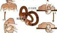 耳石复位法视频,轻松缓解眩晕，恢复平衡感