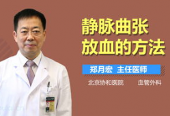 静脉曲张放血视频