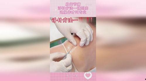 浮针疗法视频,轻松缓解疼痛，体验神奇疗效